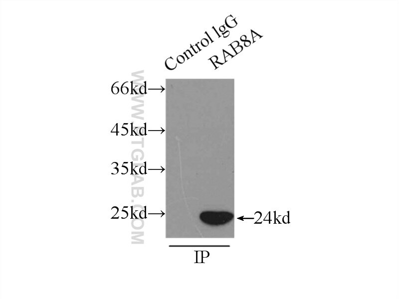 Immunoprecipitation (IP) experiment of HeLa cells using RAB8A Polyclonal antibody (55296-1-AP)