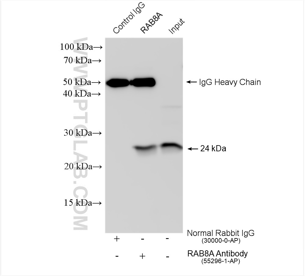 Immunoprecipitation (IP) experiment of HeLa cells using RAB8A Polyclonal antibody (55296-1-AP)