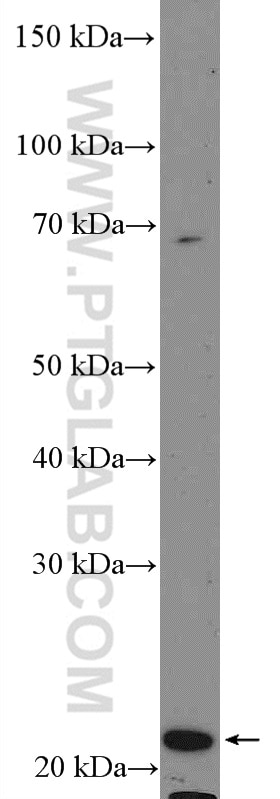 Western Blot (WB) analysis of HepG2 cells using RAB8A Polyclonal antibody (55296-1-AP)