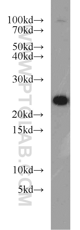 Western Blot (WB) analysis of human brain tissue using RAB8A Polyclonal antibody (55296-1-AP)