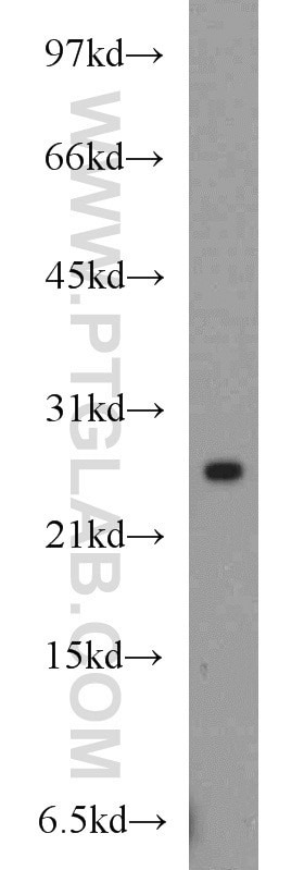 Western Blot (WB) analysis of mouse lung tissue using RAB8A Polyclonal antibody (55296-1-AP)