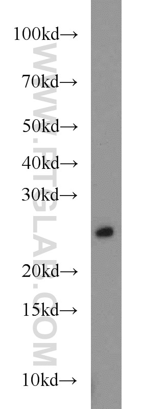 Western Blot (WB) analysis of mouse skin tissue using RAB8A Polyclonal antibody (55296-1-AP)