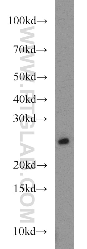 WB analysis of mouse skin using 55296-1-AP