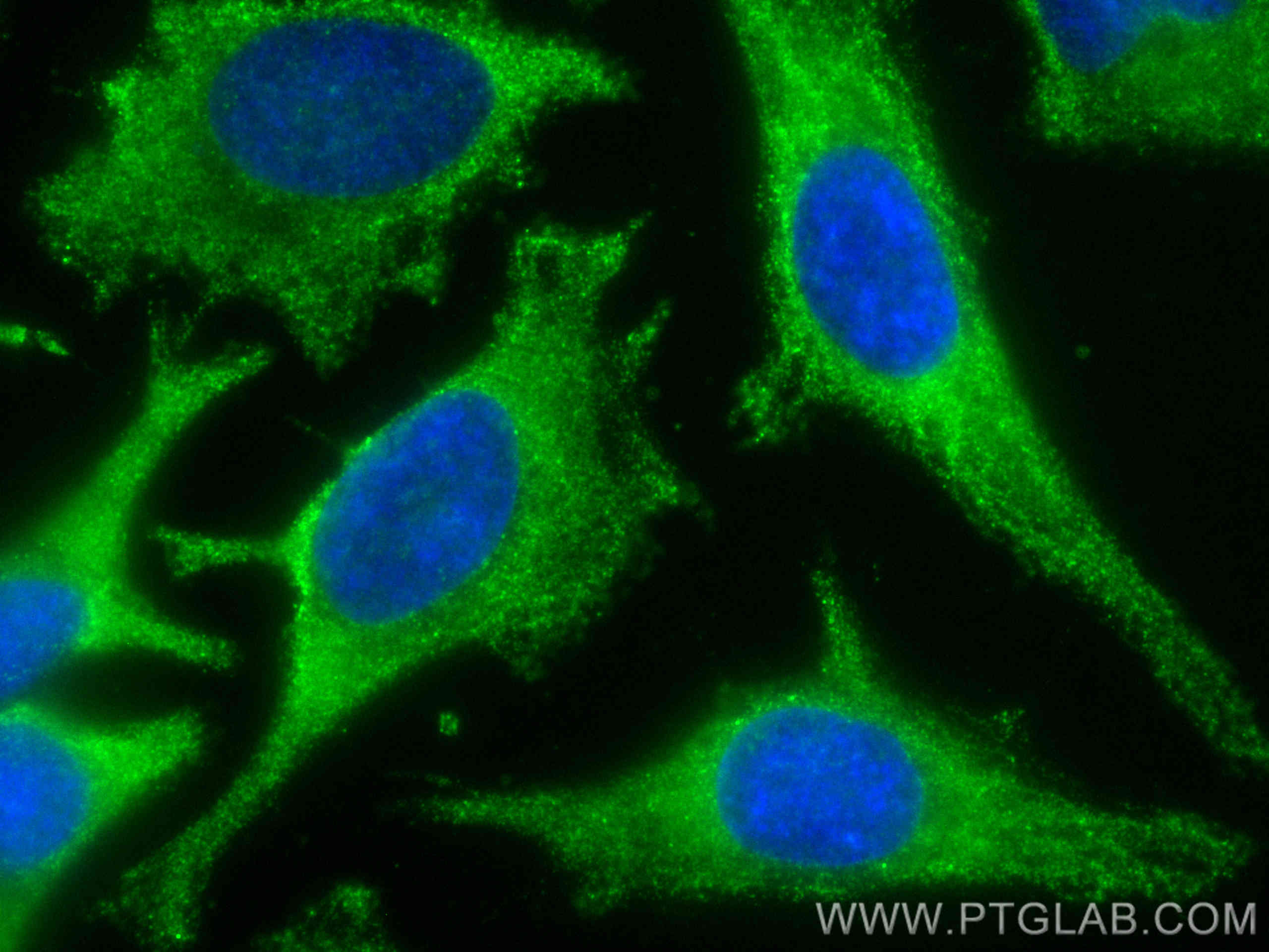 Immunofluorescence (IF) / fluorescent staining of HeLa cells using CoraLite® Plus 488-conjugated RAB8A Monoclonal ant (CL488-67536)