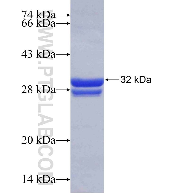RAB8A fusion protein Ag30567 SDS-PAGE