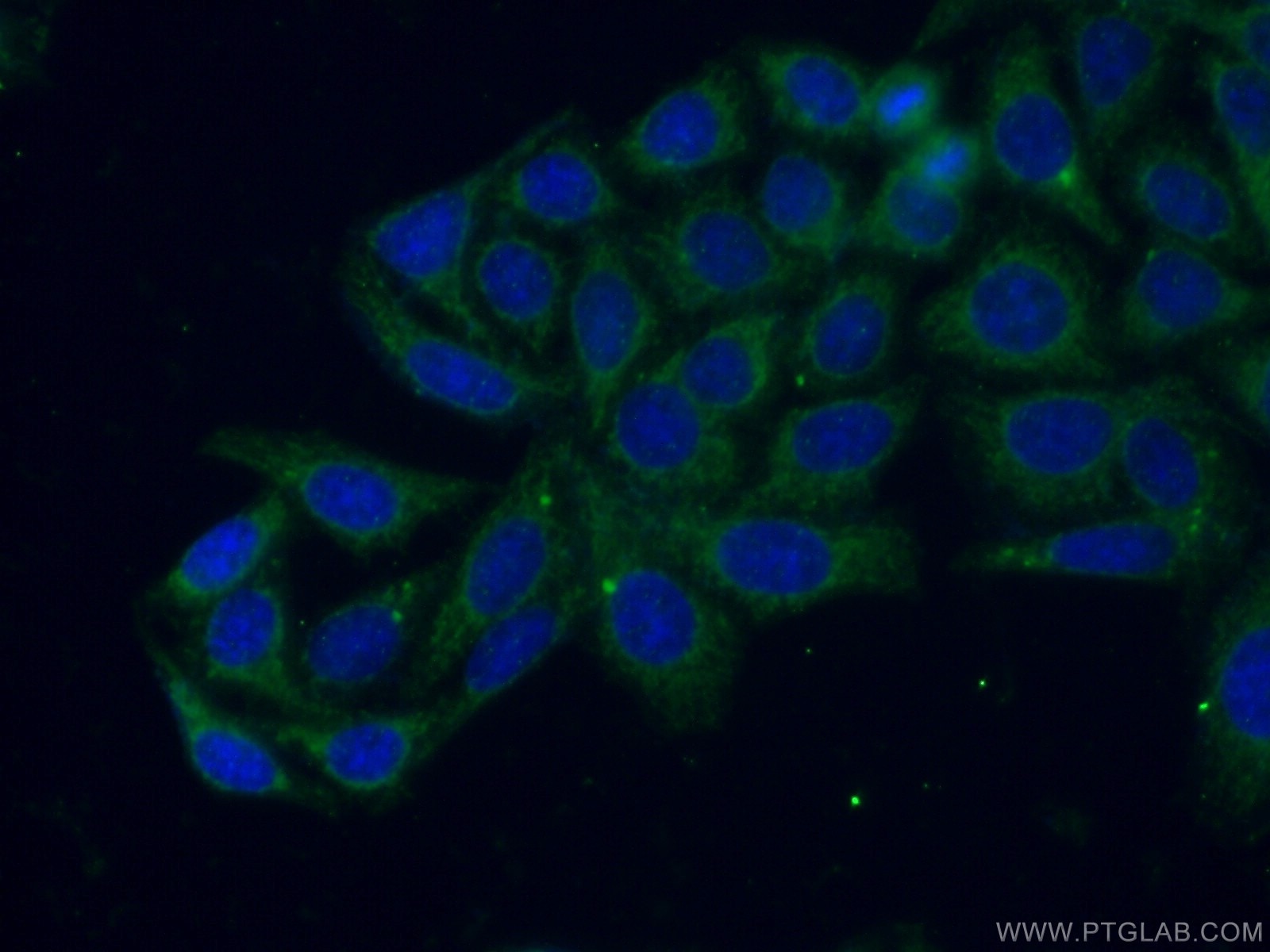 Immunofluorescence (IF) / fluorescent staining of HepG2 cells using RAB8 Polyclonal antibody (11792-1-AP)