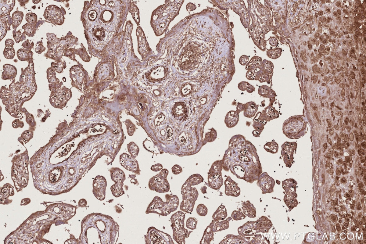Immunohistochemistry (IHC) staining of human placenta tissue using RAB8 Polyclonal antibody (11792-1-AP)