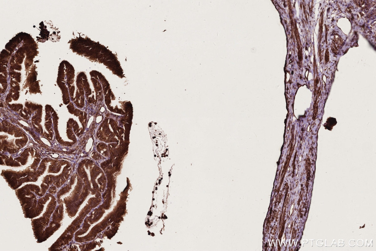 Immunohistochemistry (IHC) staining of rat ovary tissue using RAB8 Polyclonal antibody (11792-1-AP)