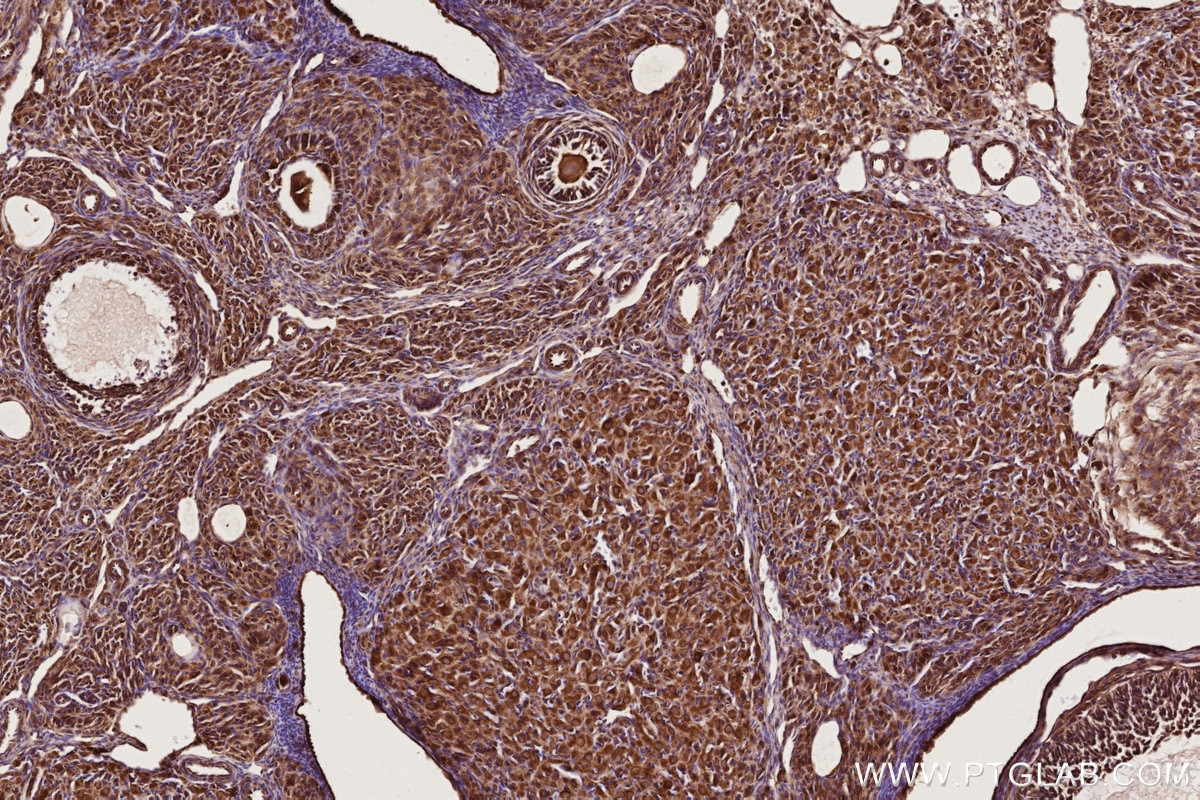 Immunohistochemistry (IHC) staining of rat ovary tissue using RAB8 Polyclonal antibody (11792-1-AP)
