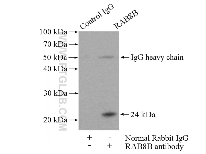 Immunoprecipitation (IP) experiment of mouse brain tissue using RAB8 Polyclonal antibody (11792-1-AP)