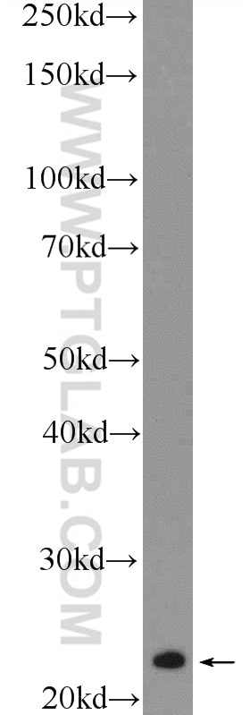 Western Blot (WB) analysis of fetal human brain tissue using RAB8 Polyclonal antibody (11792-1-AP)