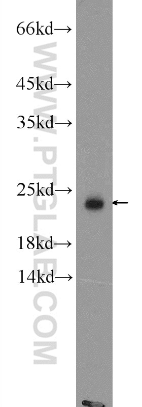 Western Blot (WB) analysis of fetal human brain tissue using RAB8 Polyclonal antibody (11792-1-AP)
