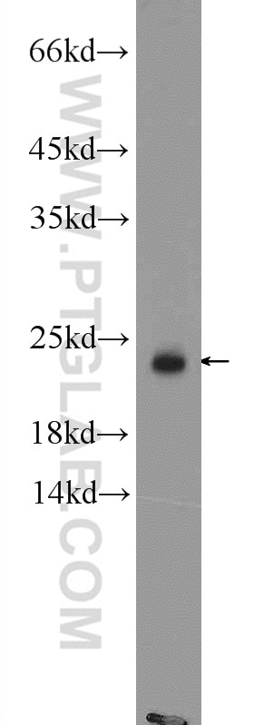 WB analysis of fetal human brain using 11792-1-AP