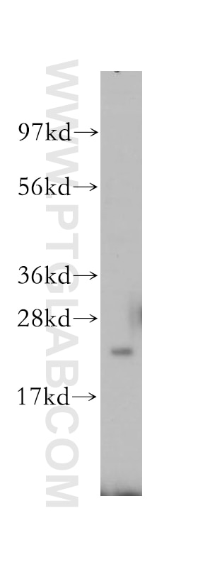 Western Blot (WB) analysis of human brain tissue using RAB8 Polyclonal antibody (11792-1-AP)