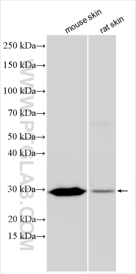 Western Blot (WB) analysis of various lysates using RAB8B Polyclonal antibody (55295-1-AP)