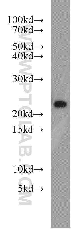 Western Blot (WB) analysis of human brain tissue using RAB8B Polyclonal antibody (55295-1-AP)