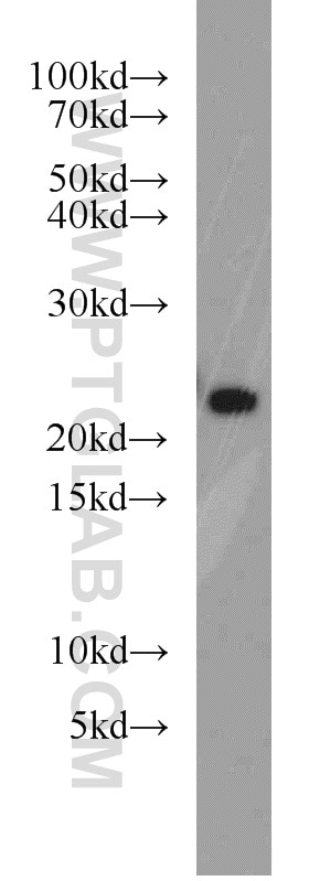 WB analysis of human brain using 55295-1-AP