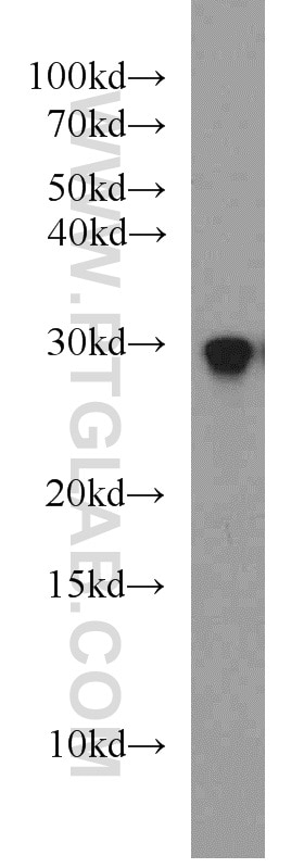 Western Blot (WB) analysis of mouse skin tissue using RAB8B Polyclonal antibody (55295-1-AP)