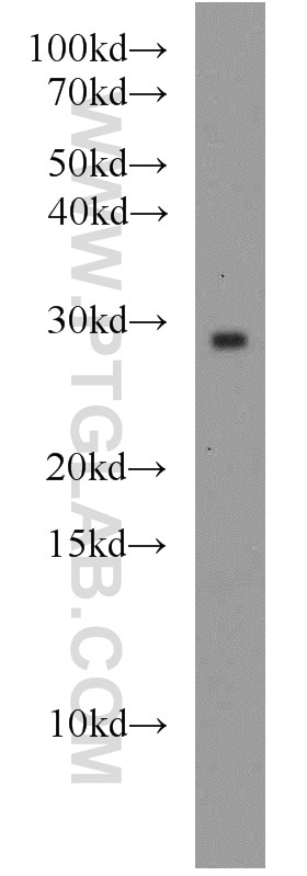 Western Blot (WB) analysis of mouse colon tissue using RAB8B Polyclonal antibody (55295-1-AP)