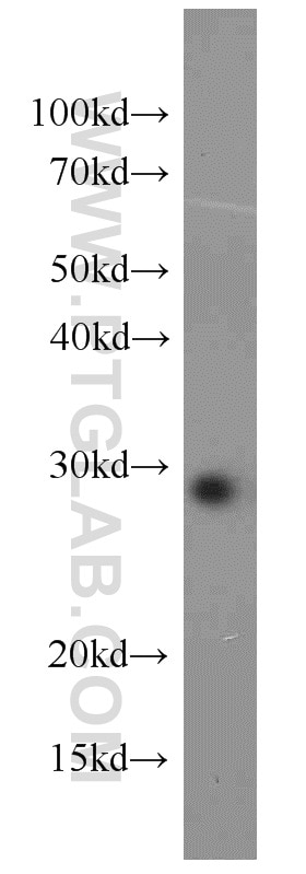 Western Blot (WB) analysis of mouse skin tissue using RAB8B Polyclonal antibody (55295-1-AP)