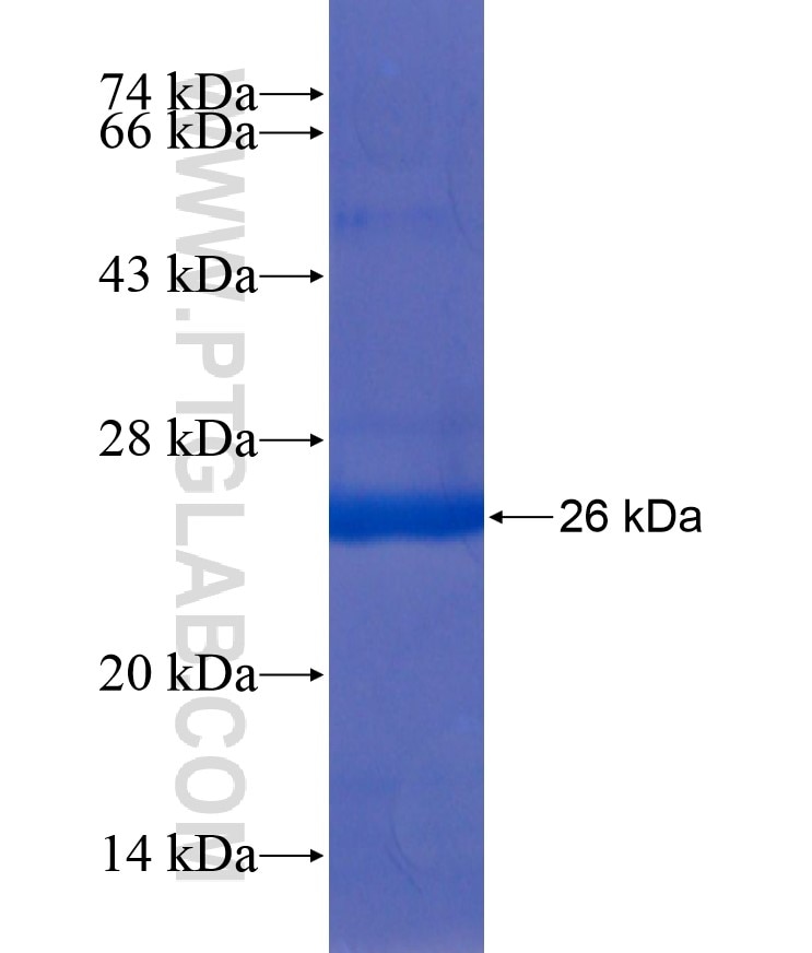 RAB8B fusion protein Ag17961 SDS-PAGE