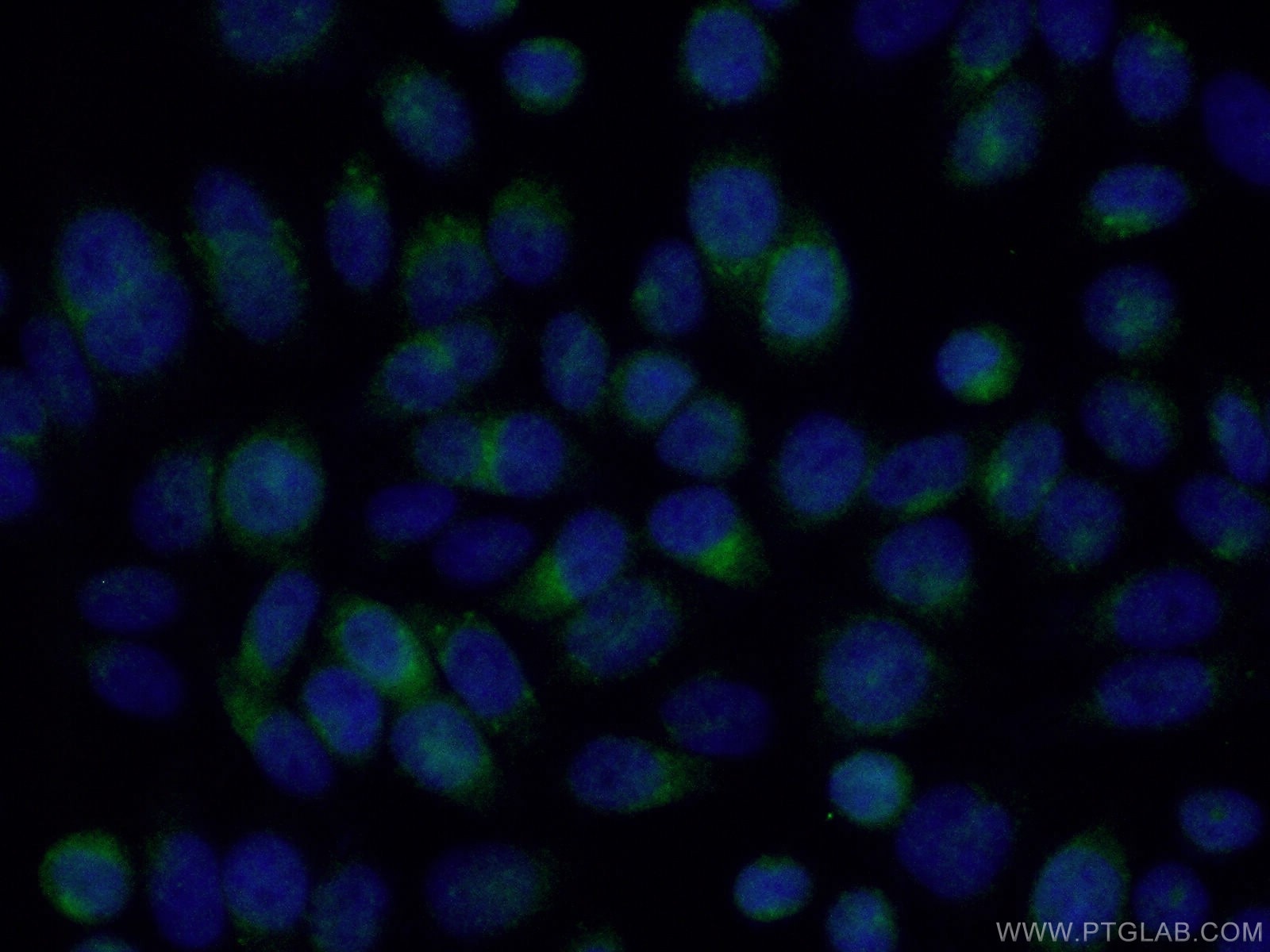 Immunofluorescence (IF) / fluorescent staining of HeLa cells using RAB9A Polyclonal antibody (11420-1-AP)