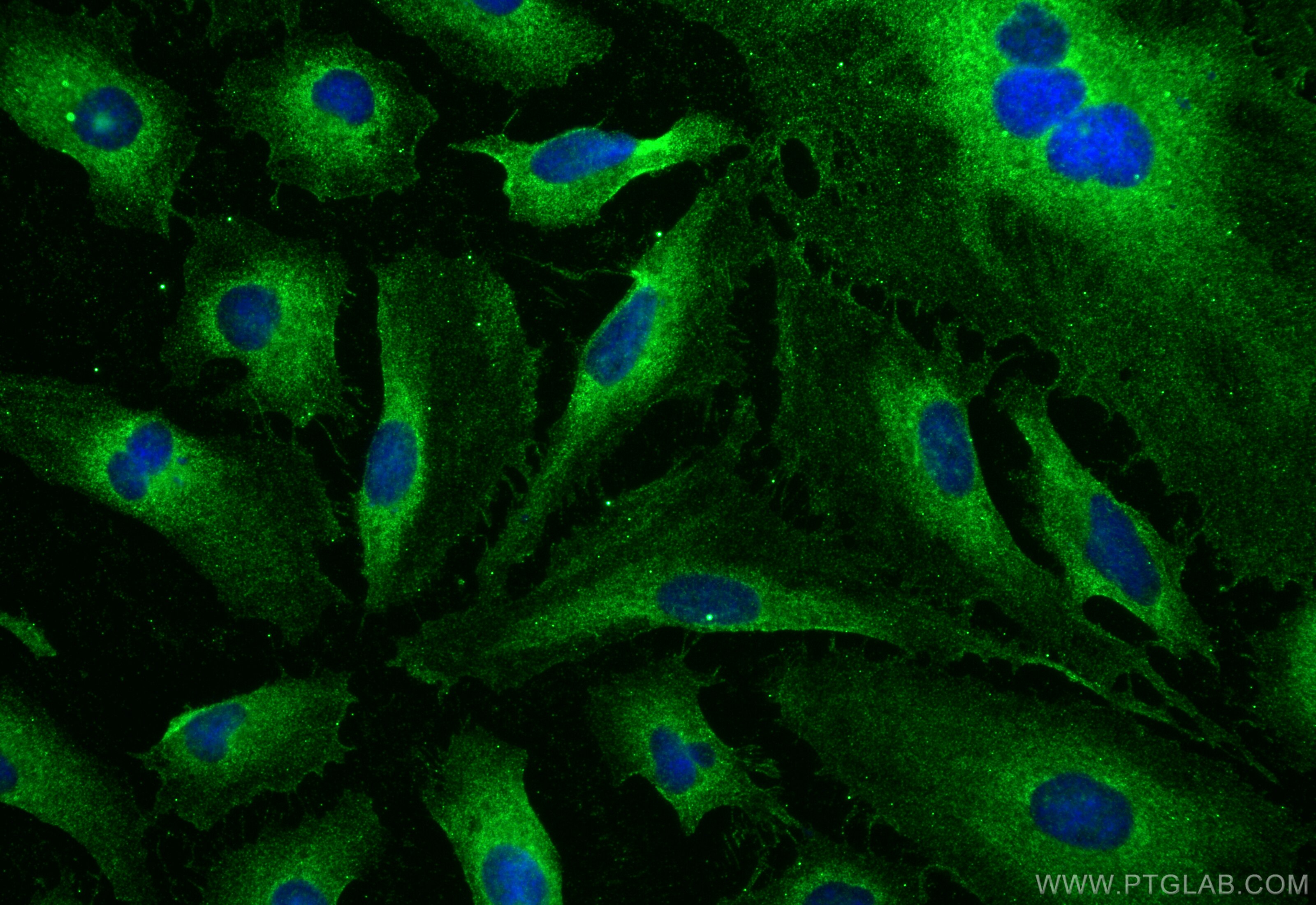 Immunofluorescence (IF) / fluorescent staining of HeLa cells using RAB9A Polyclonal antibody (11420-1-AP)