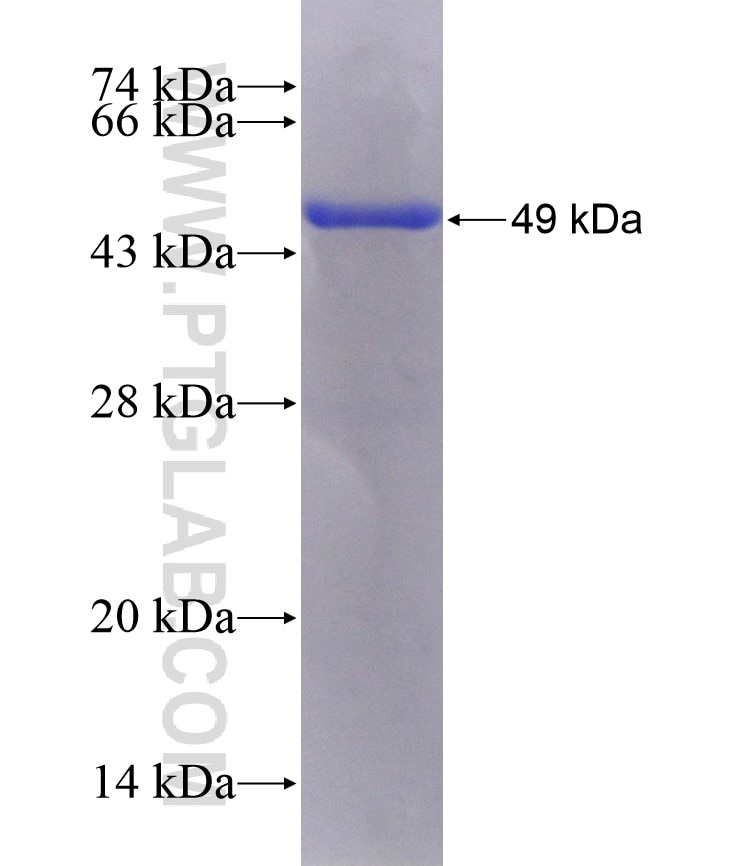 RAB9A fusion protein Ag1969 SDS-PAGE
