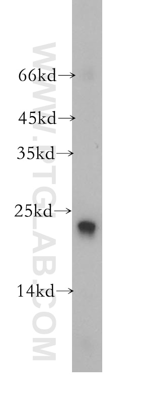 RAB9A-Specific