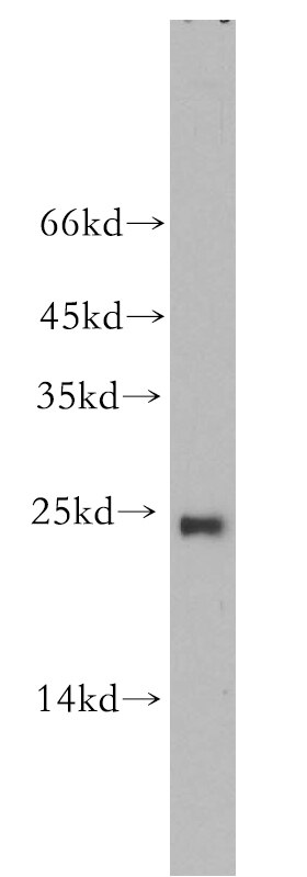Western Blot (WB) analysis of HeLa cells using RAB9A-Specific Polyclonal antibody (18719-1-AP)