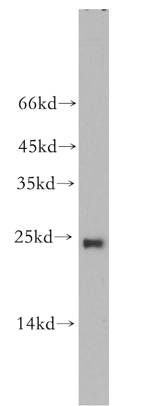 WB analysis of HeLa using 18719-1-AP