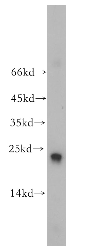 Western Blot (WB) analysis of HEK-293 cells using RAB9A-Specific Polyclonal antibody (18719-1-AP)