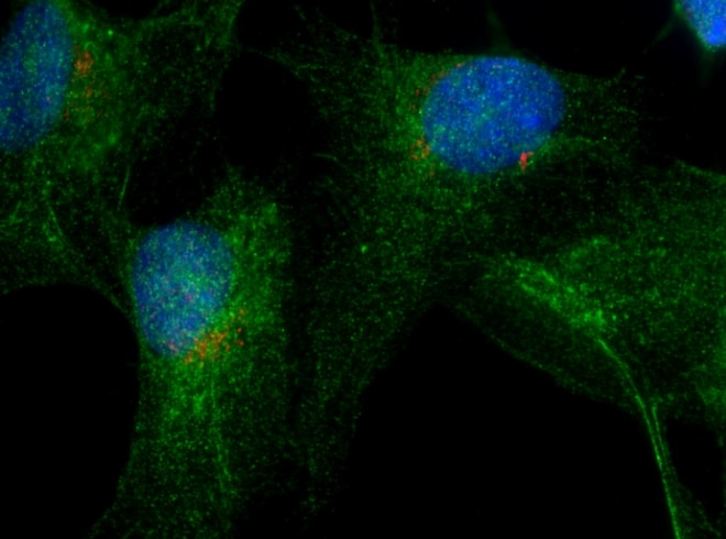Immunofluorescence (IF) / fluorescent staining of HeLa cells using RAB9B Polyclonal antibody (18152-1-AP)