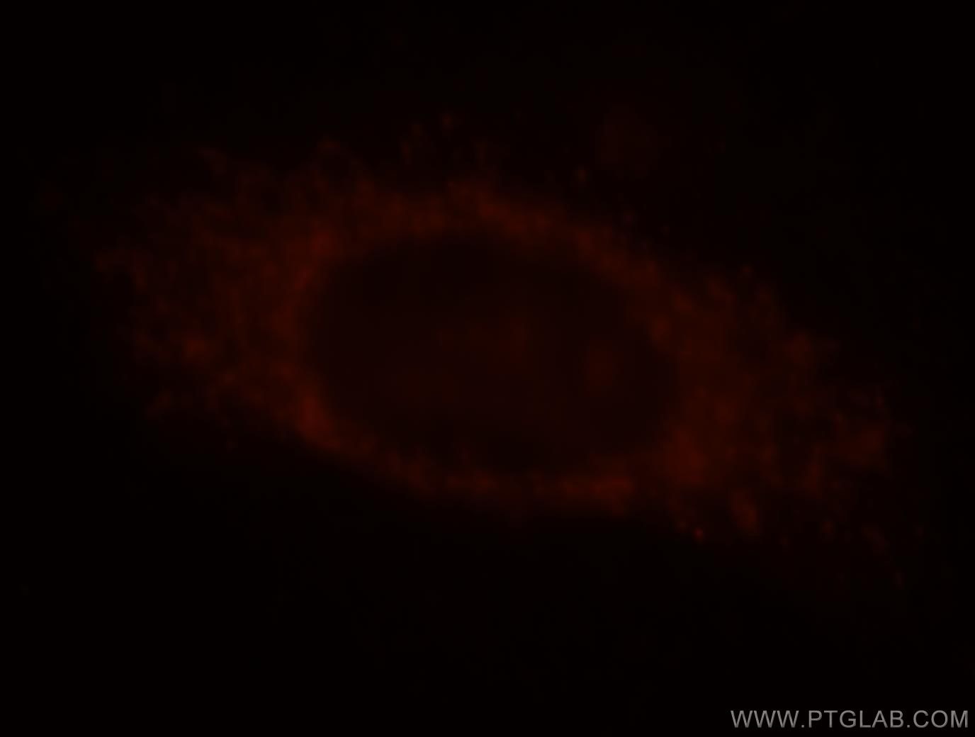 Immunofluorescence (IF) / fluorescent staining of HepG2 cells using RAB9B Polyclonal antibody (18152-1-AP)