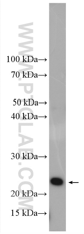 Western Blot (WB) analysis of HepG2 cells using RAB9B Polyclonal antibody (18152-1-AP)