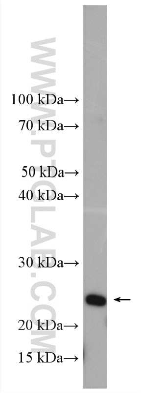 Western Blot (WB) analysis of HeLa cells using RAB9B Polyclonal antibody (18152-1-AP)