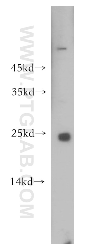 Western Blot (WB) analysis of mouse brain tissue using RAB9B Polyclonal antibody (18152-1-AP)