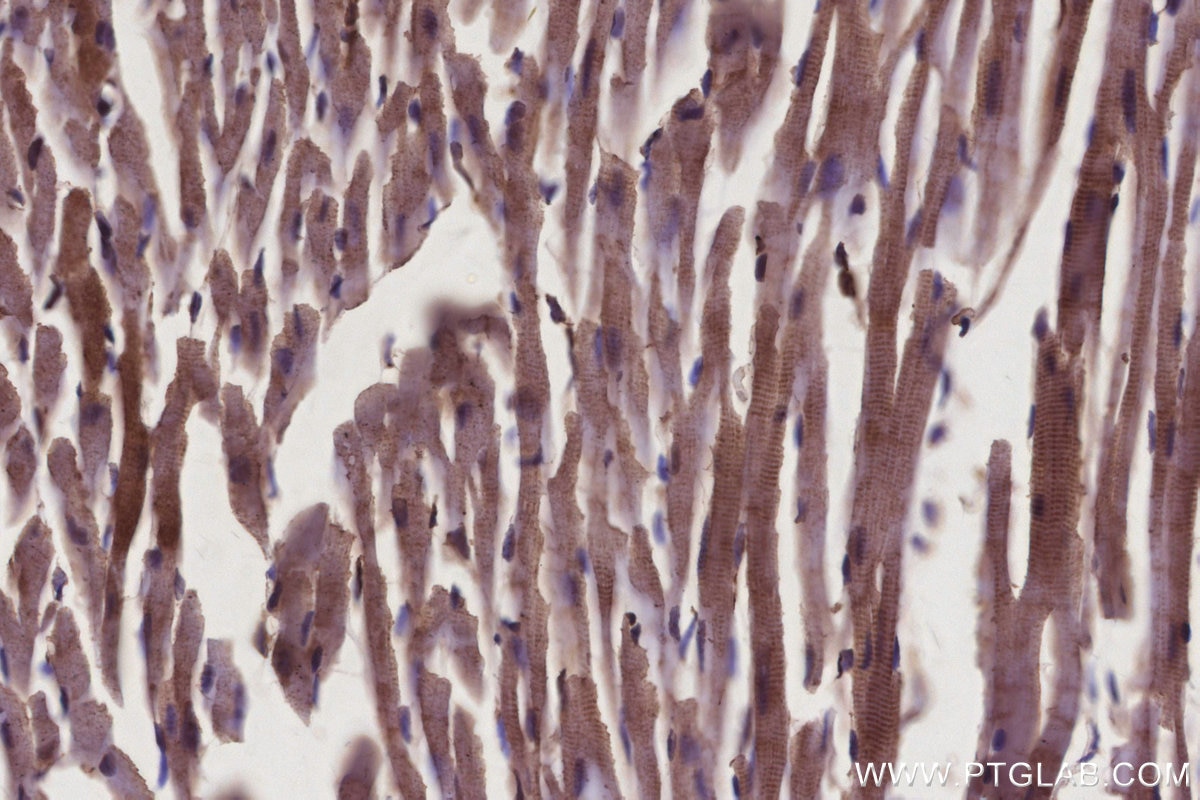 IHC staining of mouse heart using 68031-1-Ig Immunohistochemistry (IHC) staining of mouse heart tissue using RAB9B Monoclonal antibody (68031-1-Ig)