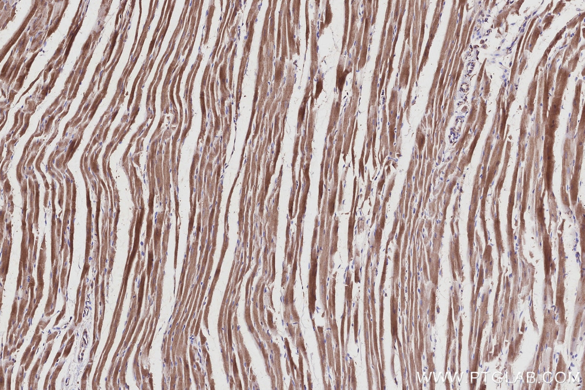 IHC staining of rat heart using 68031-1-Ig Immunohistochemistry (IHC) staining of rat heart tissue using RAB9B Monoclonal antibody (68031-1-Ig)