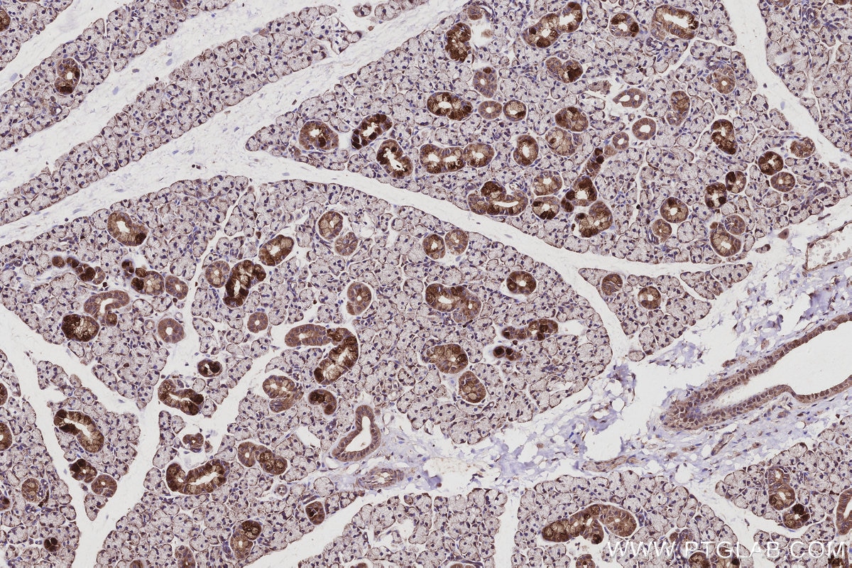 IHC staining of rat salivary gland using 68031-1-Ig Immunohistochemistry (IHC) staining of rat salivary gland tissue using RAB9B Monoclonal antibody (68031-1-Ig)