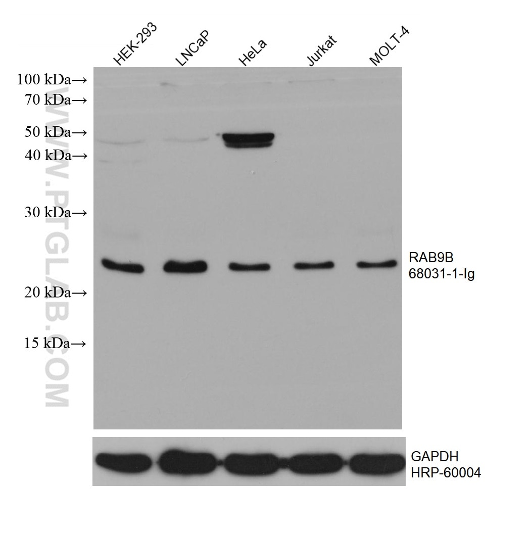 Western Blot (WB) analysis of various lysates using RAB9B Monoclonal antibody (68031-1-Ig)