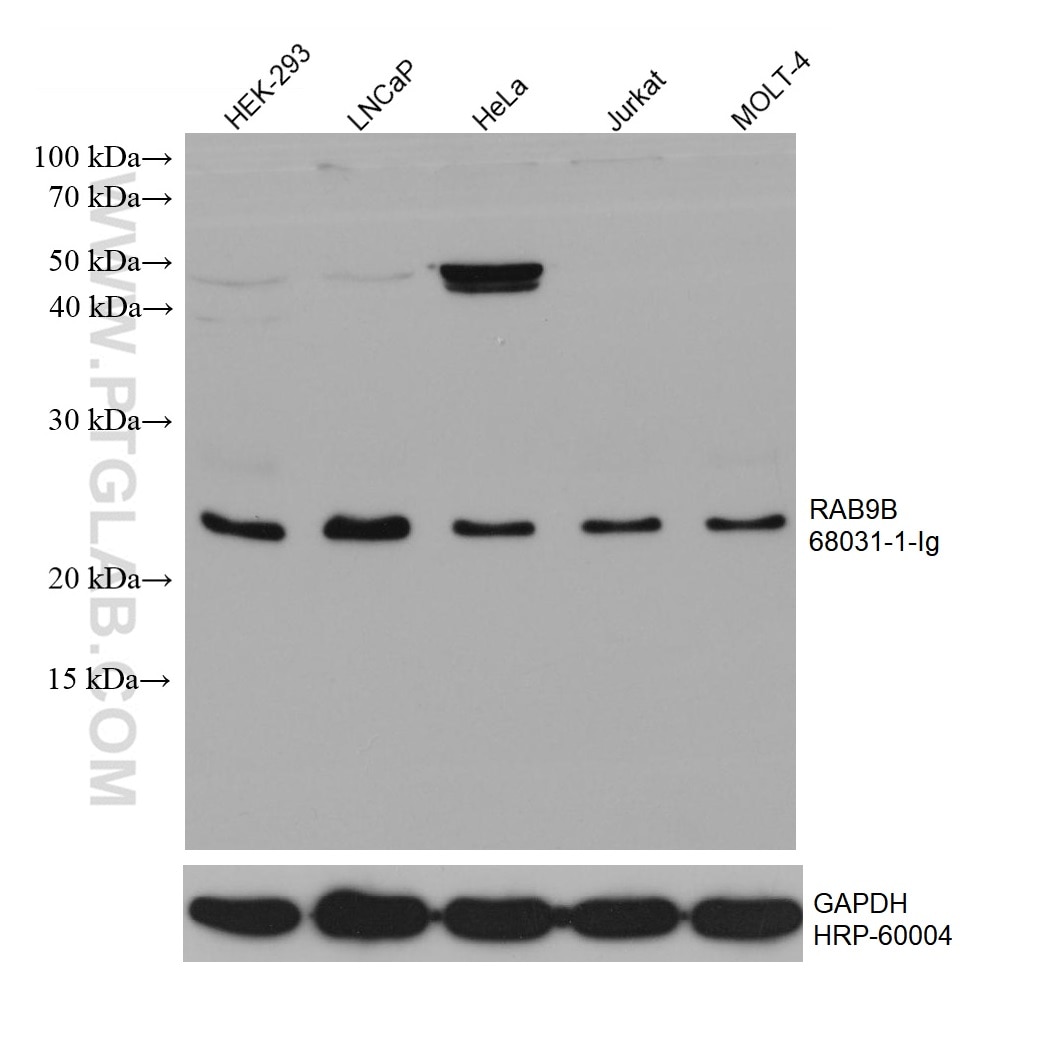 WB analysis using 68031-1-Ig