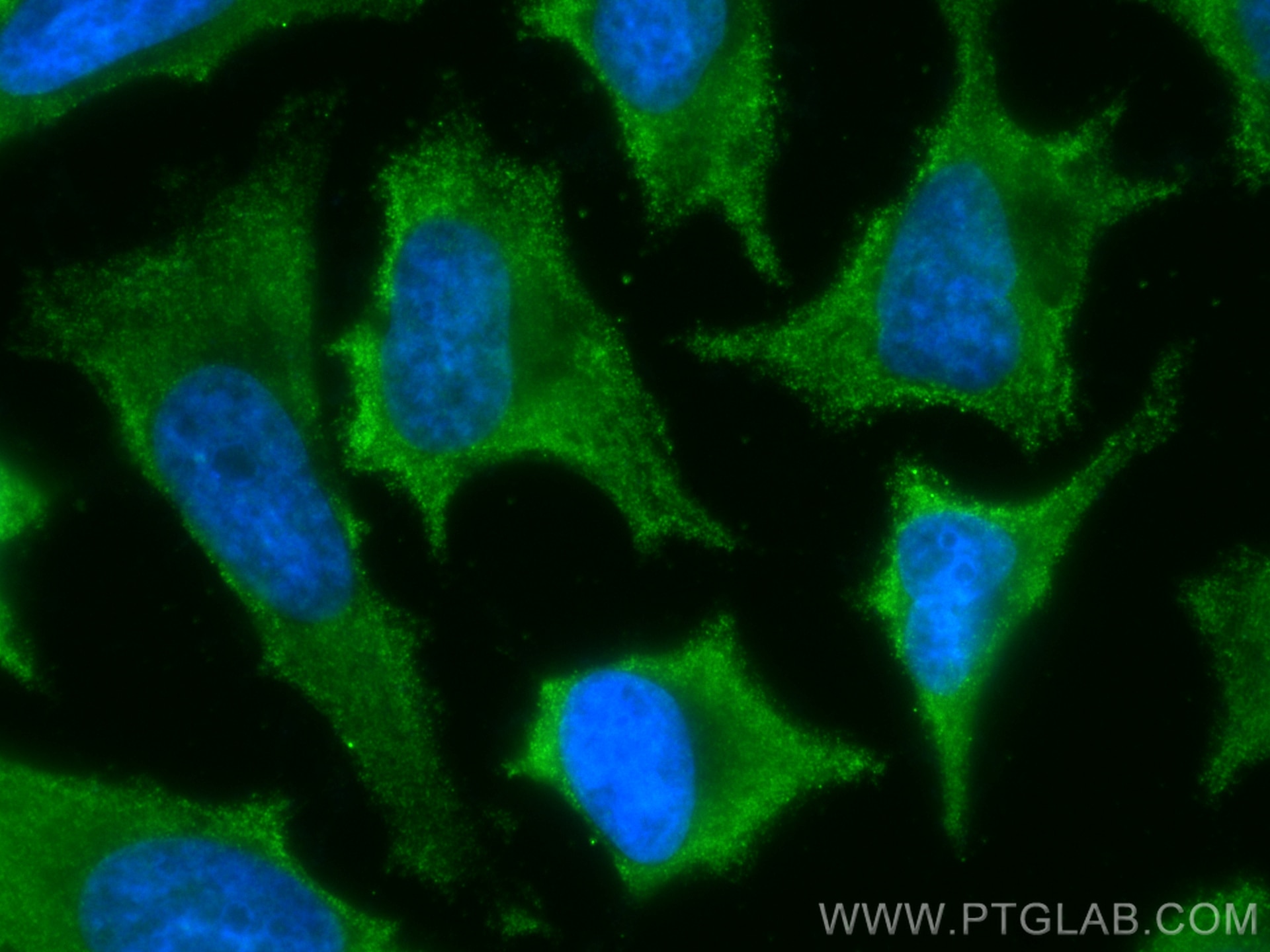 Immunofluorescence (IF) / fluorescent staining of HeLa cells using CoraLite® Plus 488-conjugated RAB9B Monoclonal ant (CL488-68031)