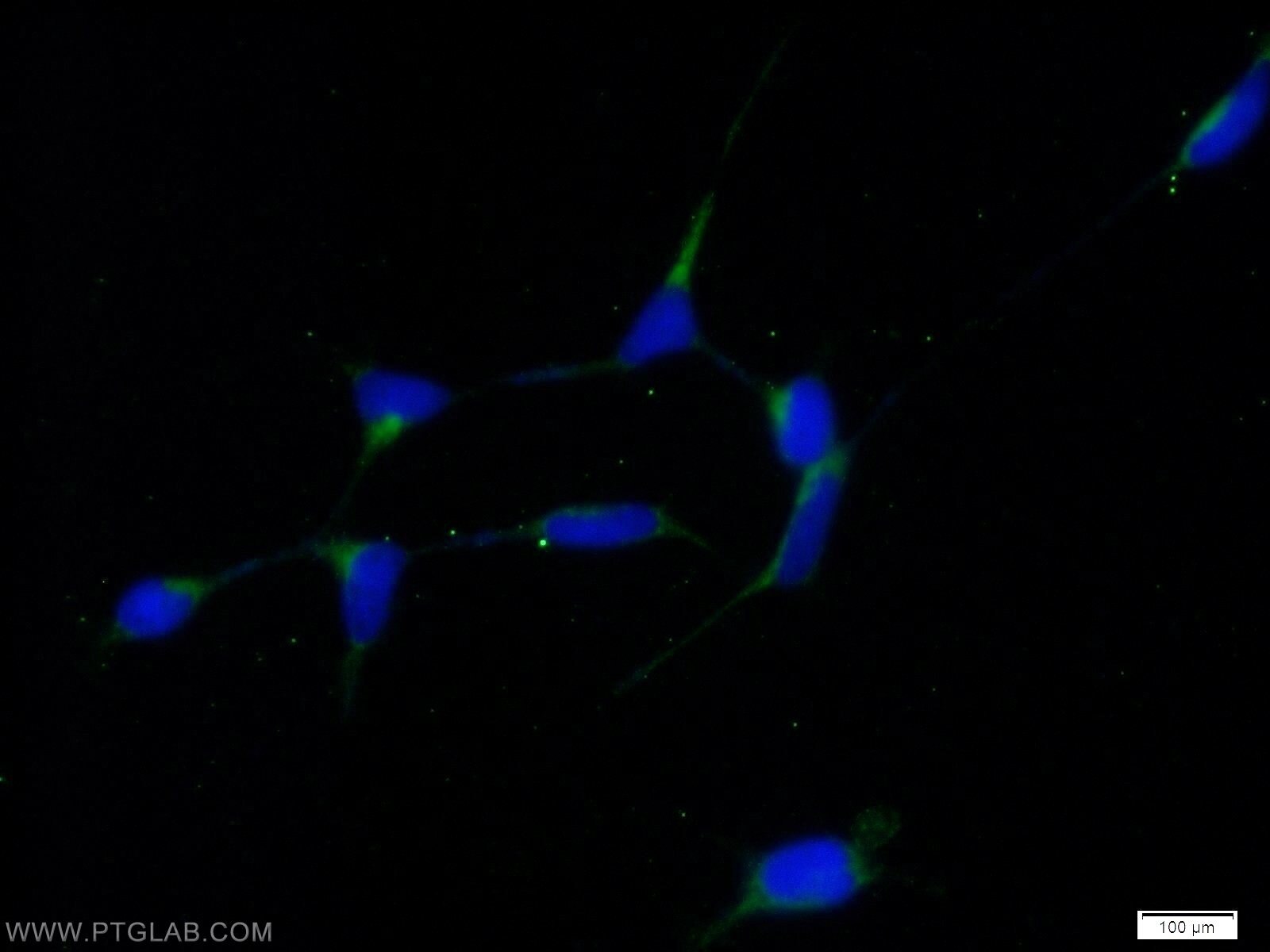 IF Staining of HEK-293 using 10542-1-AP