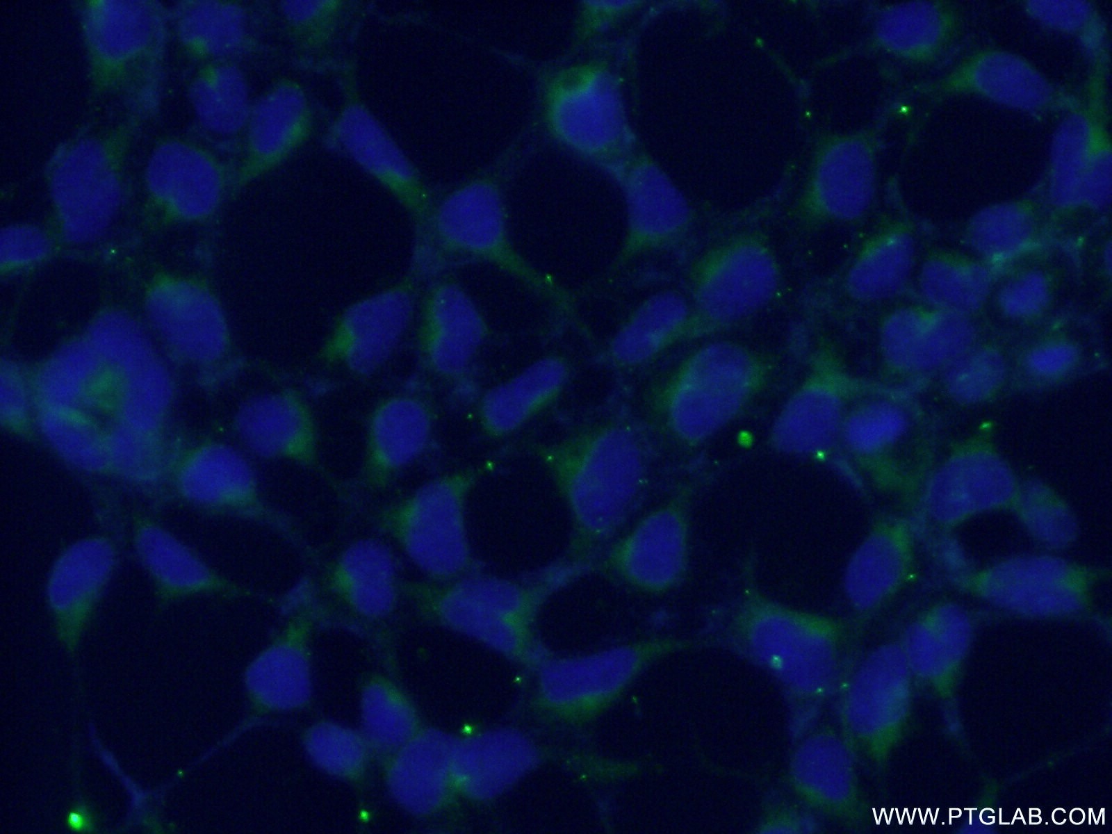 Immunofluorescence (IF) / fluorescent staining of HEK-293 cells using RABAC1 Polyclonal antibody (10542-1-AP)