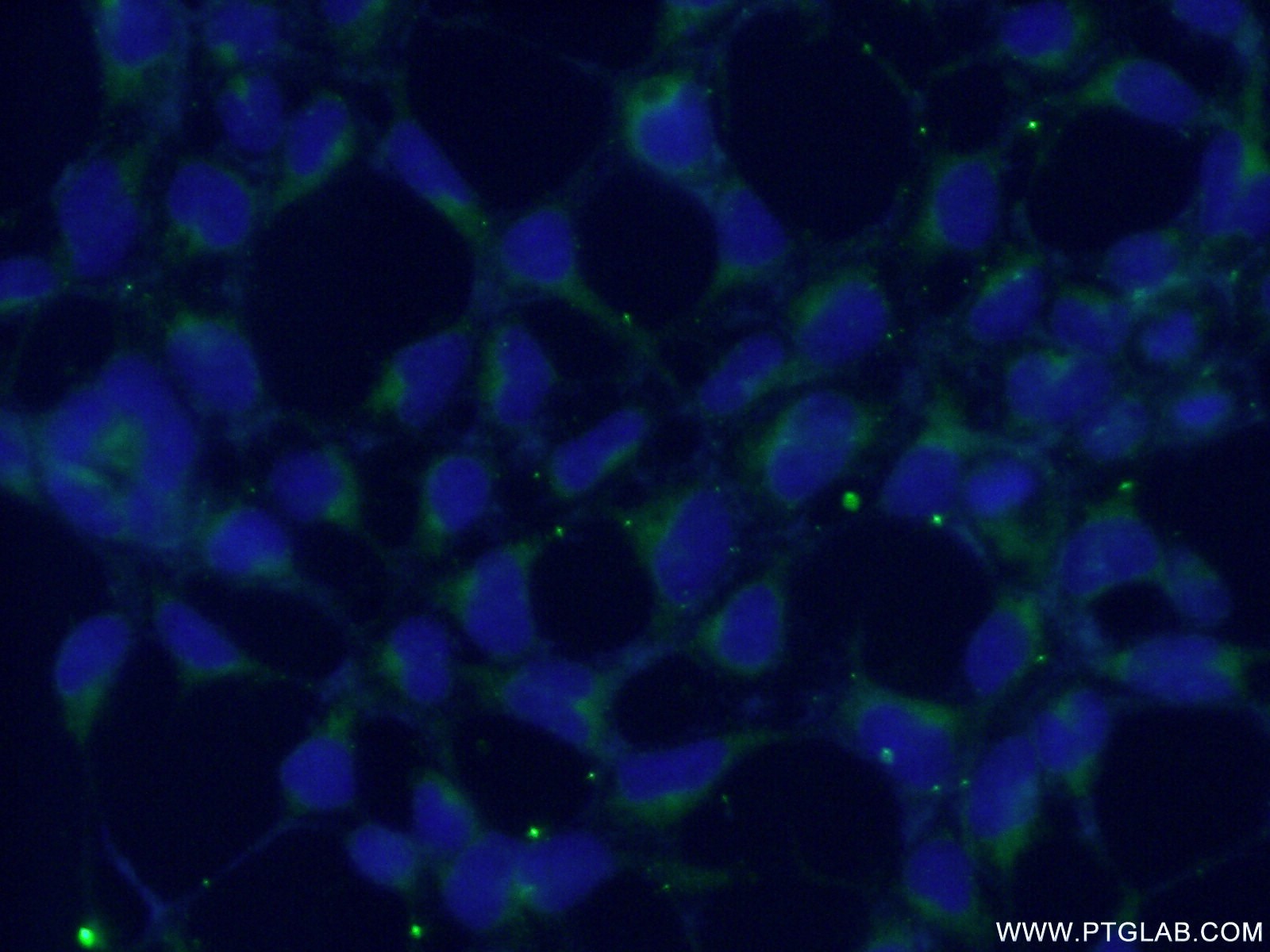 IF Staining of HEK-293 using 10542-1-AP