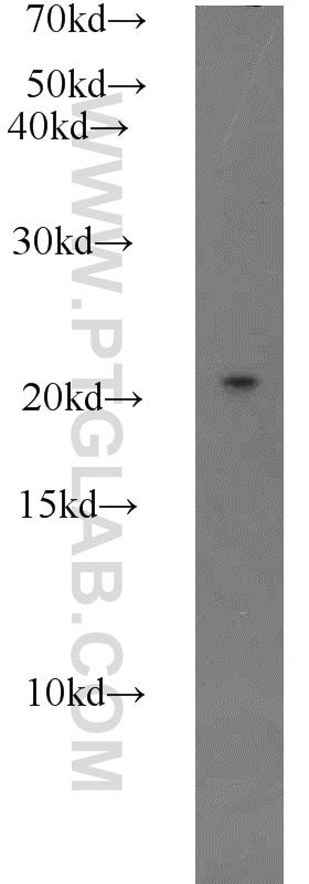 Western Blot (WB) analysis of HEK-293 cells using RABAC1 Polyclonal antibody (10542-1-AP)