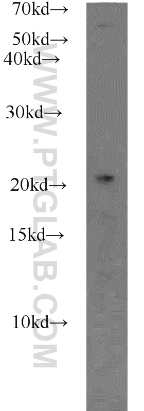 Western Blot (WB) analysis of HEK-293 cells using RABAC1 Polyclonal antibody (10542-1-AP)