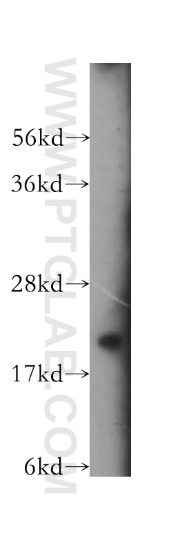 Western Blot (WB) analysis of HEK-293 cells using RABAC1 Polyclonal antibody (10542-1-AP)