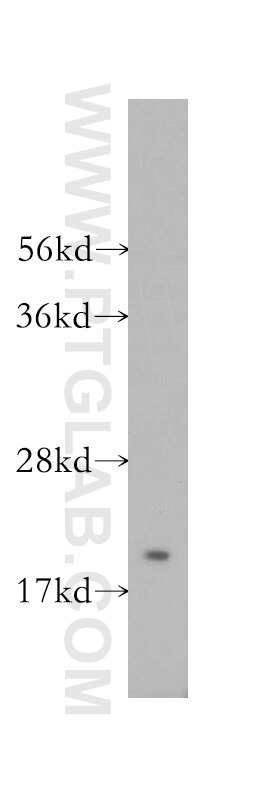 Western Blot (WB) analysis of HEK-293 cells using RABAC1 Polyclonal antibody (10542-1-AP)